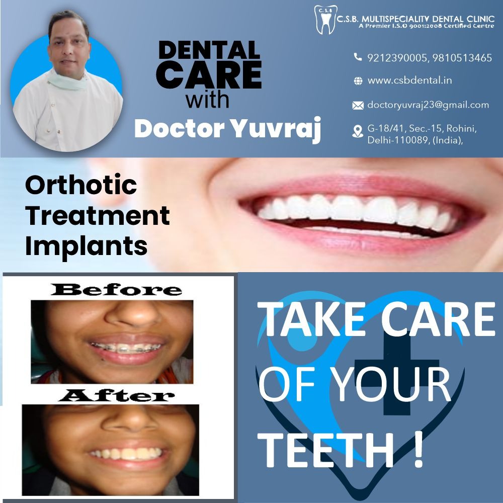 Oral & Maxillofacial Surgery in rohini sector 15, Delhi 